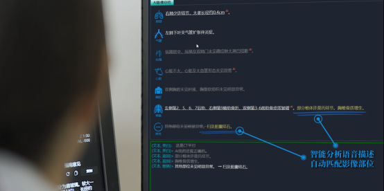 联影智能亮相WAIC，推出混合模态最新大模型产品uAI影智医声报告系统